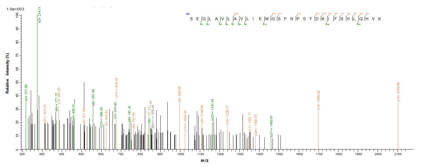 Human CA12 protein