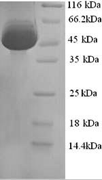 Mouse Calr protein
