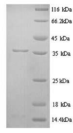 Rat Chrm1 protein