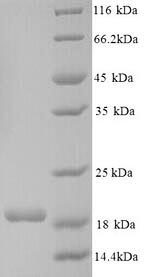 Human CNKSR2 protein