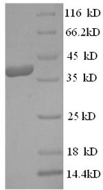 Human CPA3 protein