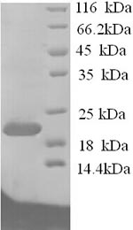 Rat Efna1 protein