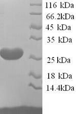 Rat Efna5 protein