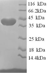 Human ELAVL2 protein