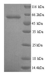 Human GPC6 protein