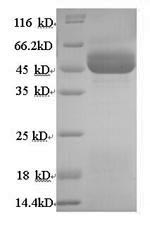 Human HSD11B2 protein