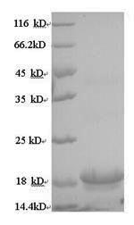 Yeast IL10 protein