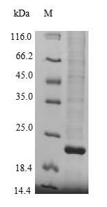 Human KDM5A protein