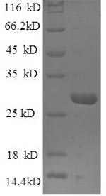 Human MBL2 protein