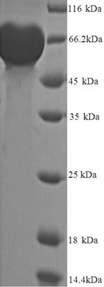 Human MMP9 protein