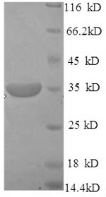 Human MPG protein