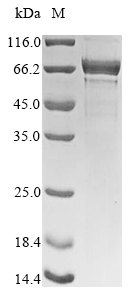 Human NCL protein