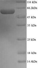 Mouse Pdia2 protein