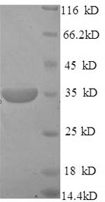 Mouse Pitx3 protein