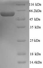 Human PRAME protein