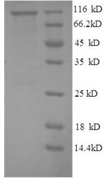 Human PYGL protein
