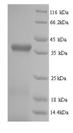 Bovine RBP3 protein