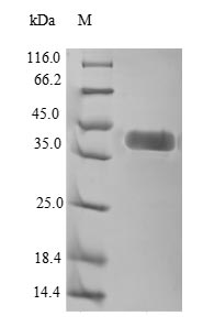 Human ROR1 protein