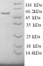 Human SAG protein