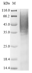 Human SEPP1 protein