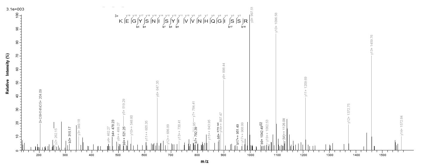 Human SEPP1 protein