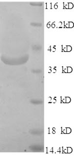 Human SLC27A2 protein
