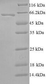 Human SMARCA2 protein
