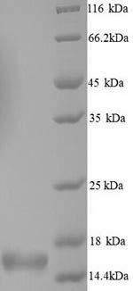 Human NACP PAPK1 protein