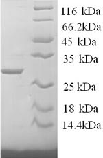 Mouse Tpsab1 protein