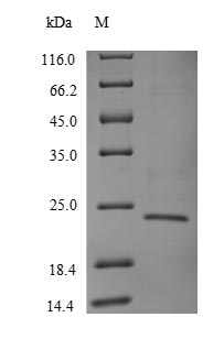 Human TRBC1 protein