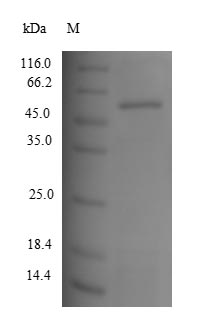 Human TYR protein
