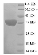 Human UCP1 protein