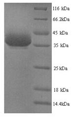 Mouse Ybx1 protein