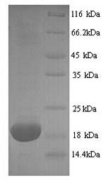 Mouse Mup2 protein