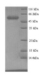 E. coli glpD protein