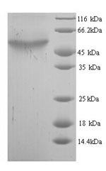 E. coli codA protein