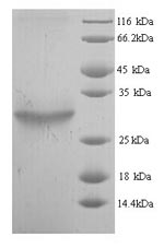 E. coli plsC protein