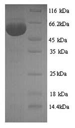 Viral NP protein