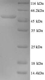 Human L2 protein