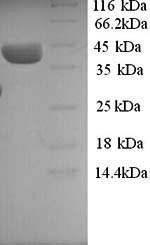 Human ELAVL3 protein
