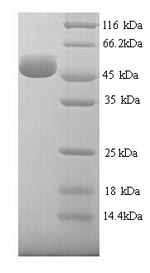 Human HYAL1 protein
