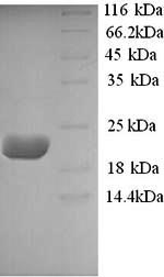 Sheep IL10 protein