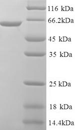 Human C1orf106 protein