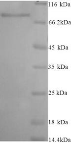 Human NAALADL2 protein