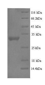 Human DLK2 protein