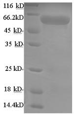 Mouse Adck2 protein
