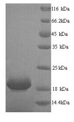 Human LYPD6 protein