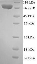 Human IL12RB2 protein