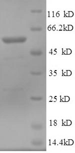 Human NT5C1A protein