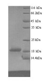 Human RAVER2 protein
